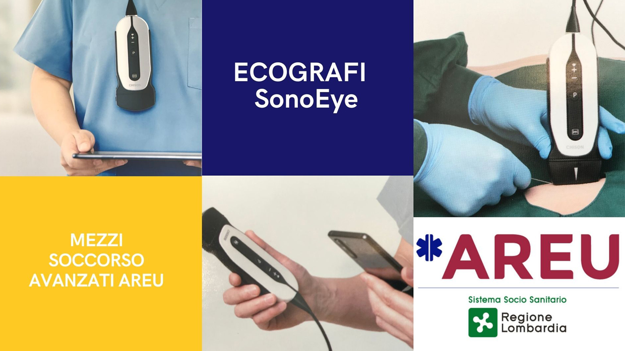 Tutorial per l’utilizzo dell’Ecografo portatile. SonoEye